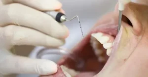 What is a periodontist